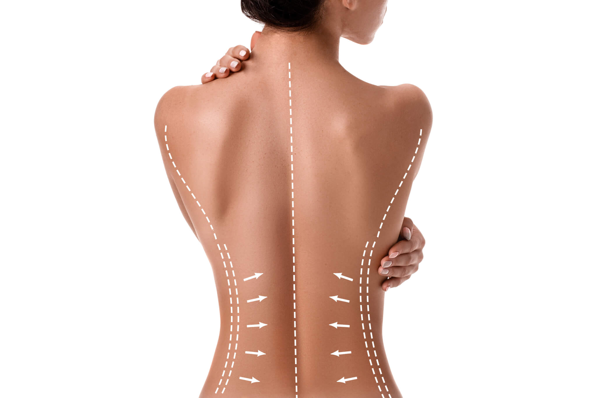 Can Liposuction Give you Abs